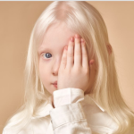 بررسی ژنتیکی زالی