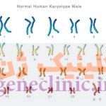تست کروموزوم یا کاریوتایپ