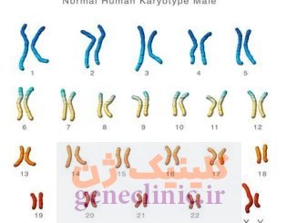 تست کروموزوم یا کاریوتایپ