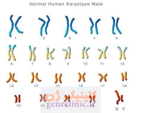 مشاوره ژنتیک، تست ژنتیک، کاریوتایپ، کروموزوم، geneclinic.ir تست کروموزوم یا کاریوتایپ