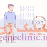 مشاوره ژنتیک سندرم کلاین فلتر، آزمایش ژنتیک سندرم کلاین فلتر