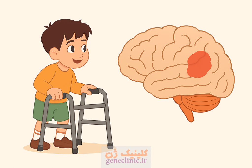 مشاوره ژنتیک فلج مغزی، CP، cerebral palsy، آزمایشگاه ژنتیک ژن
