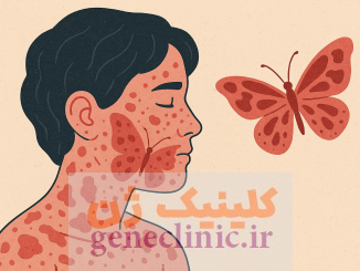 مشاوره ژنتیک‏ اپیدرمولیز بولوزا ، آزمایش ژنتیک‏ اپیدرمولیز بولوزا ، بیماری پروانه ای