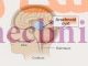 کیست آراکنویید ، Arachnoid cyst