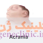 آکرانیا (Acrania) چیست؟