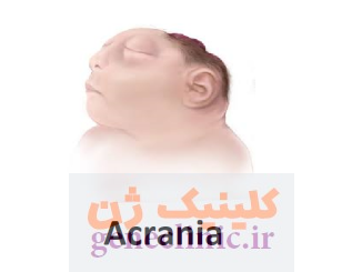 آکرانیا (Acrania) چیست؟