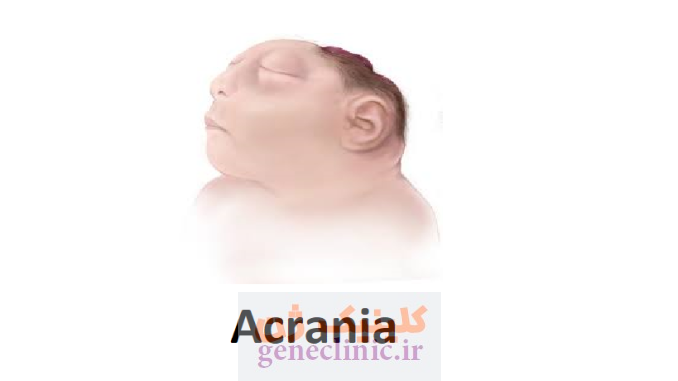 آکرانیا (Acrania) چیست؟