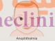 آنوفتالمی‏ (Anophthalmia) چیست؟