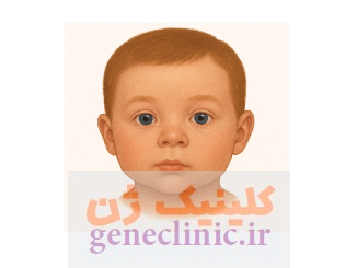 هیپوتلوریسم‏ (Hypotelorism) چیست؟