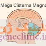 ‏مگاسیسترنا مگنا‏، Megacisterna magna