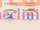‏آب مروارید‏ یا کاتاراکت (Cataract) چیست؟