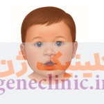 شکاف کام یا لب (Cleft lip or palate) چیست؟