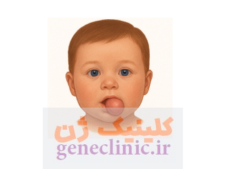 اپیگناتوس‏ (Epignathus) چیست؟