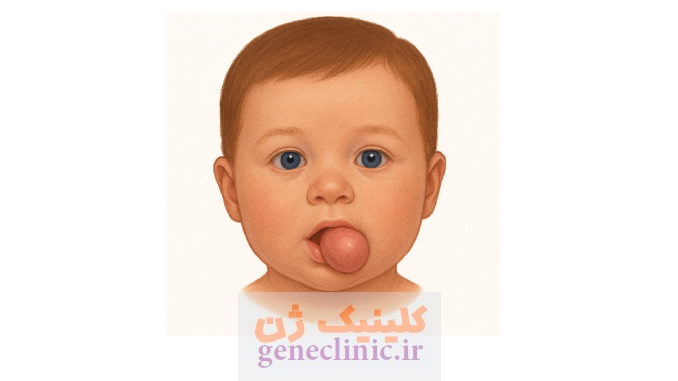 اپیگناتوس‏ (Epignathus) چیست؟