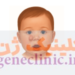 داکریوسیستوسل‏ (Dacryocystocele) چیست؟