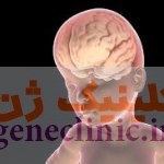 ماکروسفالی‏، Macrocephaly