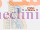 سیستیک هیگروما یا هیگرومای کیستیک (Cystic hygroma) چیست؟