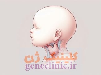 گواتر تیروئید (Thyroid goitre) چیست؟