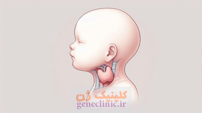 گواتر تیروئید (Thyroid goitre) چیست؟