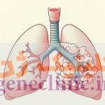 آترزی برونش‏ (Bronchial atresia) چیست؟