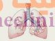 آترزی برونش‏ (Bronchial atresia) چیست؟