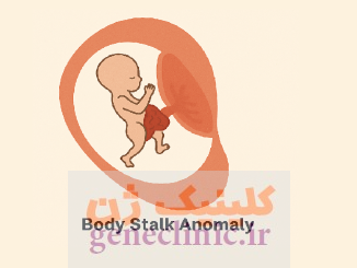 ‏ناهنجاری ساقه بدن‏ (Body stalk anomaly) چیست؟