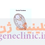 تراتوم گردن (Cervical teratoma) تراتوم گردن (Cervical teratoma) چیست؟