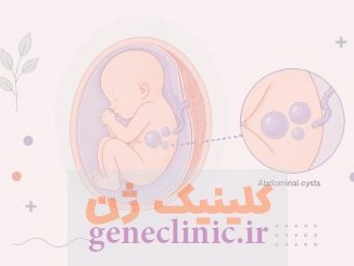 ‏کیست شکمی (Abdominal cyst)‏ چیست؟