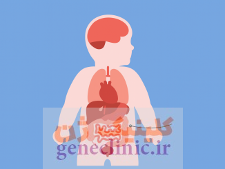 ‏کیست شکمی (Abdominal cyst)‏ چیست؟