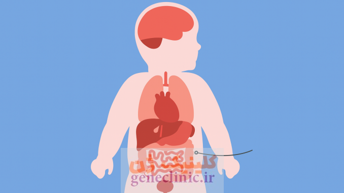 ‏کیست شکمی (Abdominal cyst)‏ چیست؟