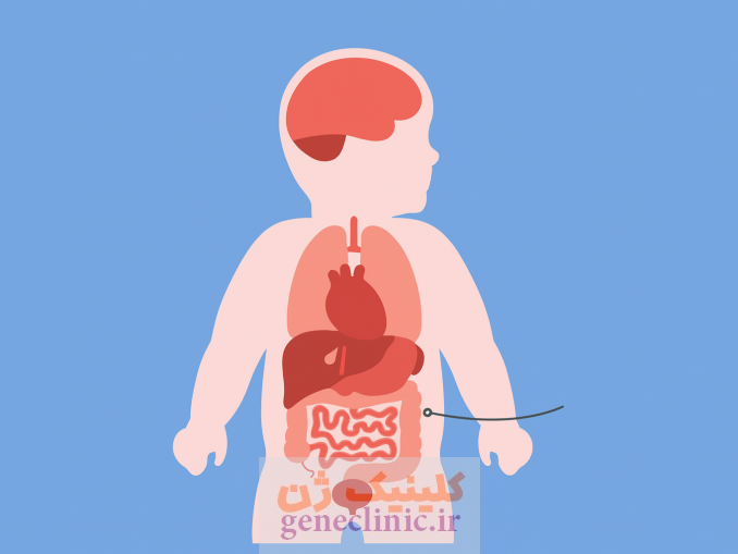 ‏کیست شکمی (Abdominal cyst)‏ چیست؟