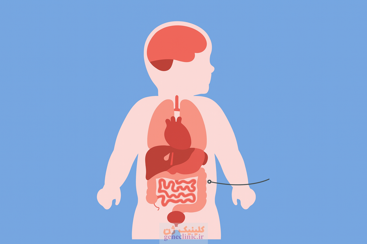 ‏کیست شکمی (Abdominal cyst)‏ چیست؟