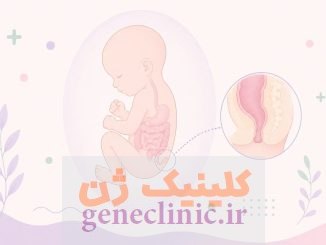 ‏آترزی آنورکتال‏ یا مقعد بسته (Anorectal atresia) چیست؟