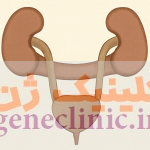 ‏کلیه نعل اسبی‏ (Horseshoe kidney) چیست؟