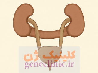 ‏کلیه نعل اسبی‏ (Horseshoe kidney) چیست؟