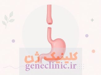 ‏آترزی مری‏ (Esophageal atresia) چیست؟