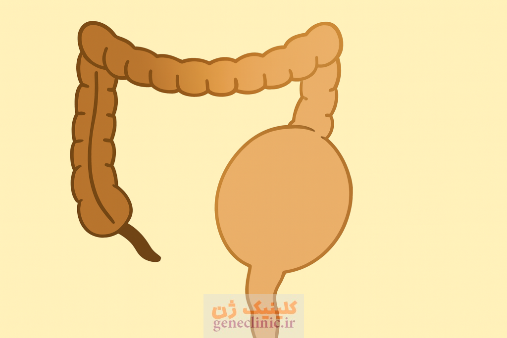 ‏بیماری هیرشپرونگ‏ (Hirschsprung's disease) چیست؟