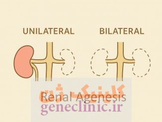 ‏آژنزی کلیه‏ (Renal agenesis) چیست؟