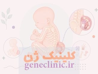 تراتوم ساکروکوکسیژیال (Sacrococcygeal teratoma) چیست؟