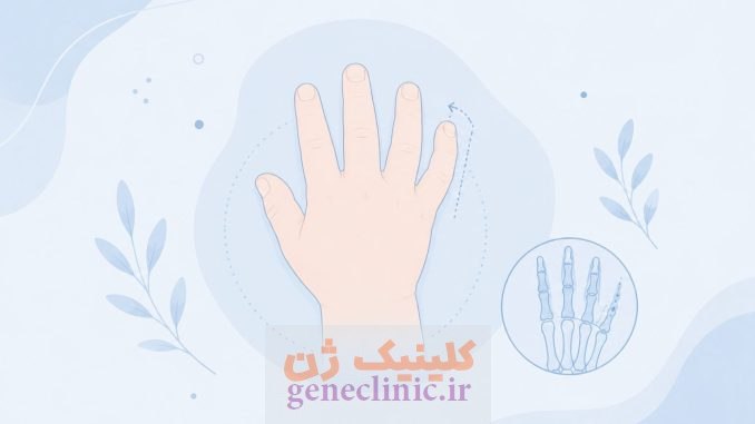 کلینوداکتیلی (Clinodactyly) چیست؟