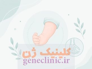 دست چنبری (Clubhands) چیست؟