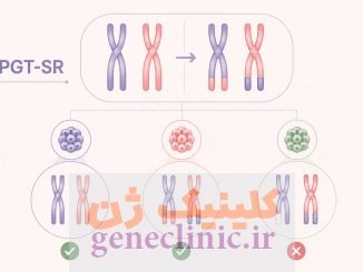 PGT-SR چیست؟