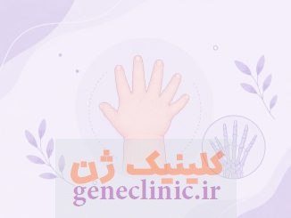 پلی‌داکتیلی (Polydactyly) چیست؟