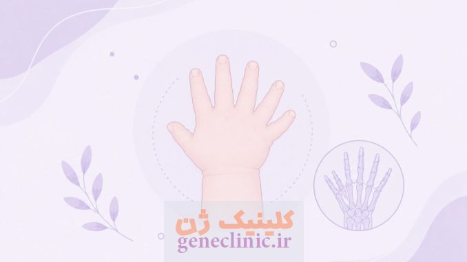 پلی‌داکتیلی (Polydactyly) چیست؟