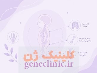 دیسپلازی اسکلتی (Skeletal dysplasia) چیست؟