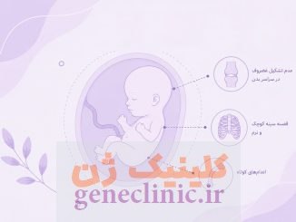 آکندروژنزیس (Achondrogenesis) چیست؟
