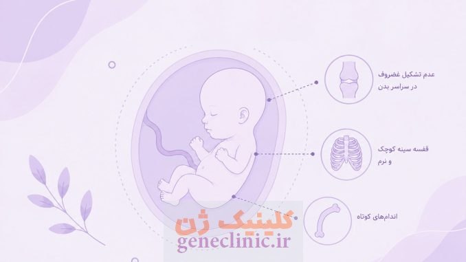 آکندروژنزیس (Achondrogenesis) چیست؟
