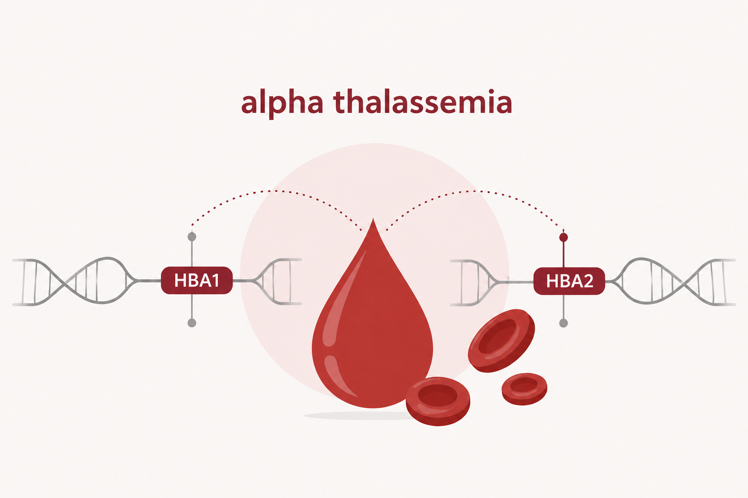 تالاسمی آلفا (Alpha Thalassemia) تالاسمی آلفا (Alpha Thalassemia) چیست؟