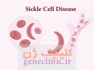 کم‌خونی داسی‌شکل (Sickle Cell Disease)چیست؟