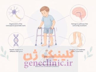 پاراپلژی اسپاستیک ارثی (Hereditary Spastic Paraplegia) چیست؟